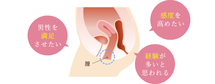 広がってしまった膣が気になっていませんか？